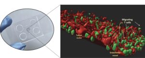 Pesquisadores desenvolvem chip 3D para tratamento de câncer raro