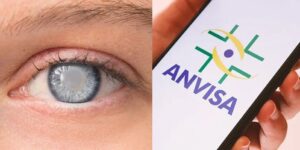 Anvisa proíbe produto que causa cegueira