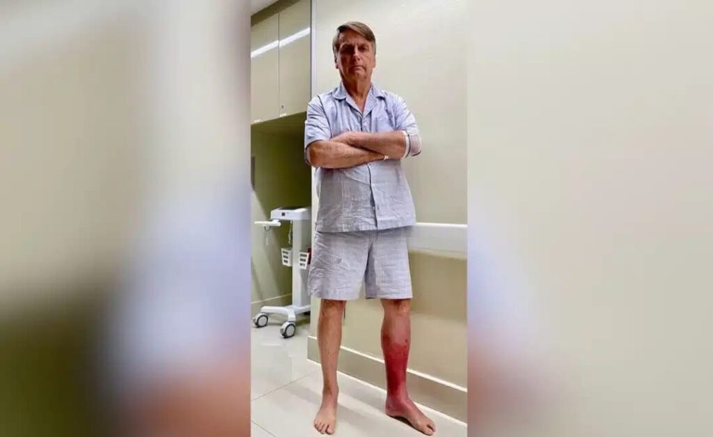 Bolsonaro, sob tratamento com antibióticos, segue internado sem previsão de alta