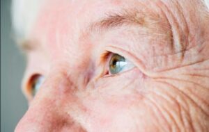 Glaucoma atinge 2,5 milhões de pessoas no país e pode causar a perda de visão irreversível