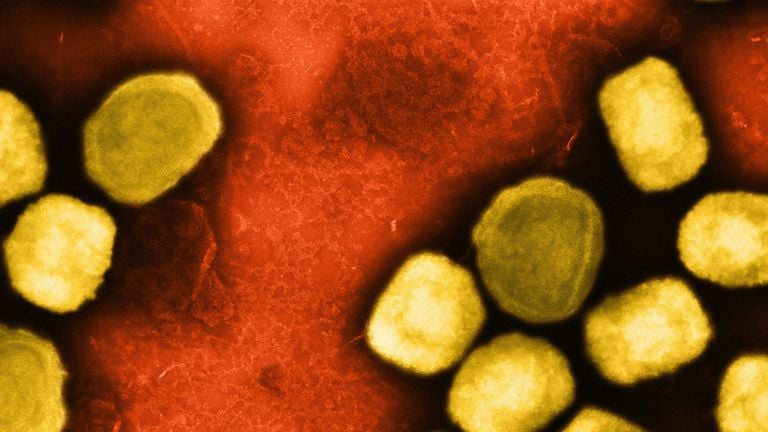 OMS alerta sobre nova variante de mpox e pede urgência