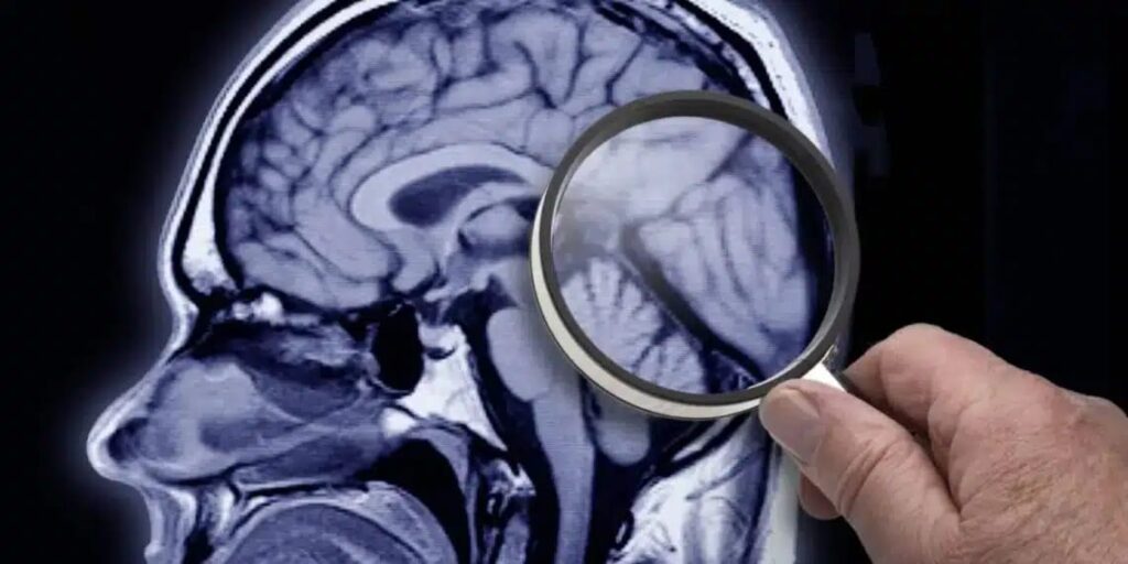 Conheça a bebida que pesquisadores sugerem ser capaz de proteger contra Alzheimer