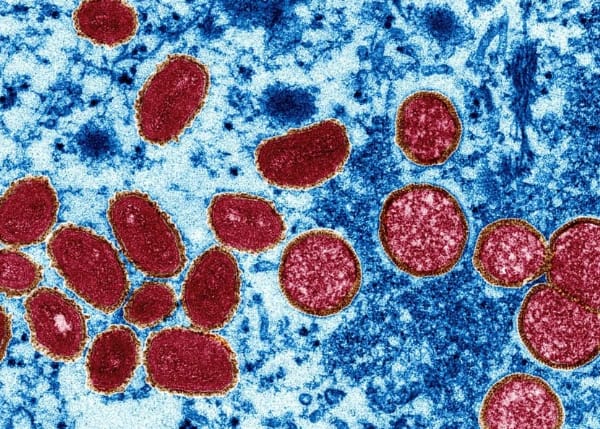 Mpox Supera 100 mil casos globais, com o Brasil entre os mais impactados