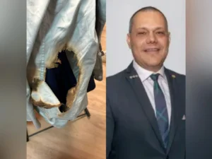 Deputado Coronel Neil sofre acidente no restaurante da Alepa e fica com queimaduras de 2º grau
