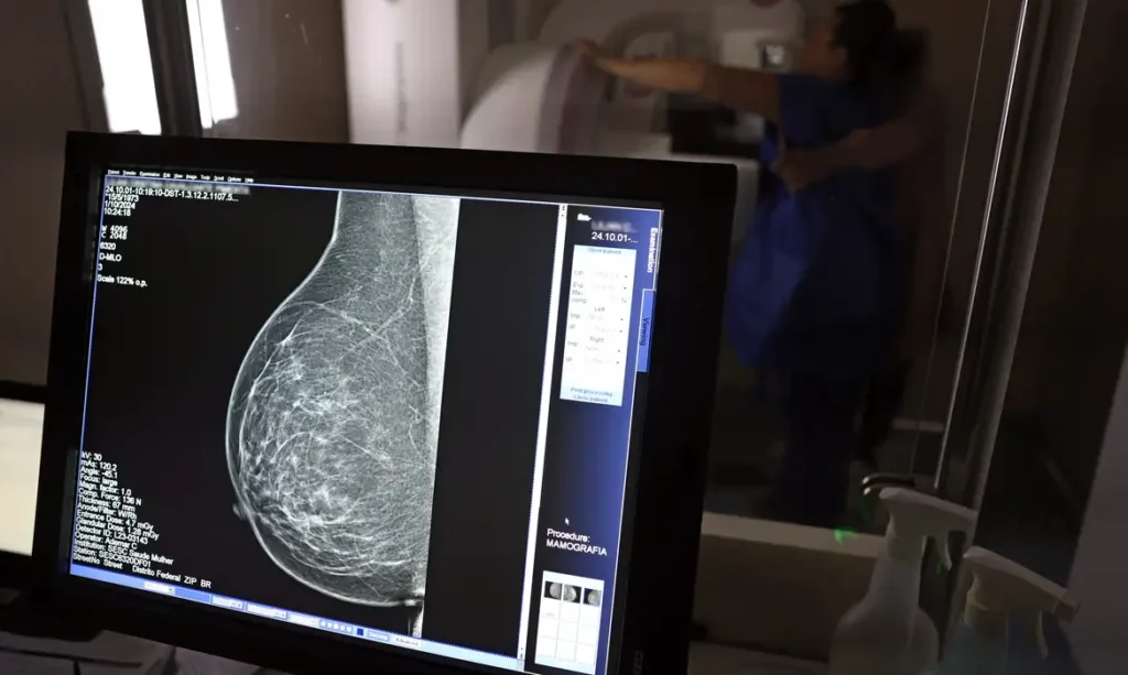 Câncer de mama: uma em cada três pacientes tem menos de 50 anos