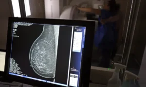 Câncer de mama: uma em cada três pacientes tem menos de 50 anos