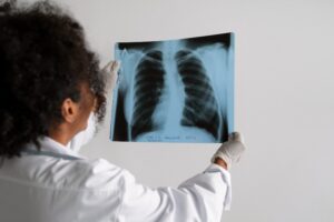 MPF aciona Justiça e pede medidas emergenciais para conter surto de tuberculose entre os Kayapó no Pará