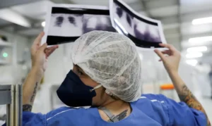 Câncer de pulmão: 15% dos casos acontecem em não fumantes