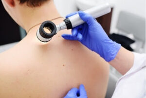 Mudanças climáticas aumentam o risco de câncer de pele: casos diagnosticados por ano cresceram 20% entre 2014 e 2025 no Brasil