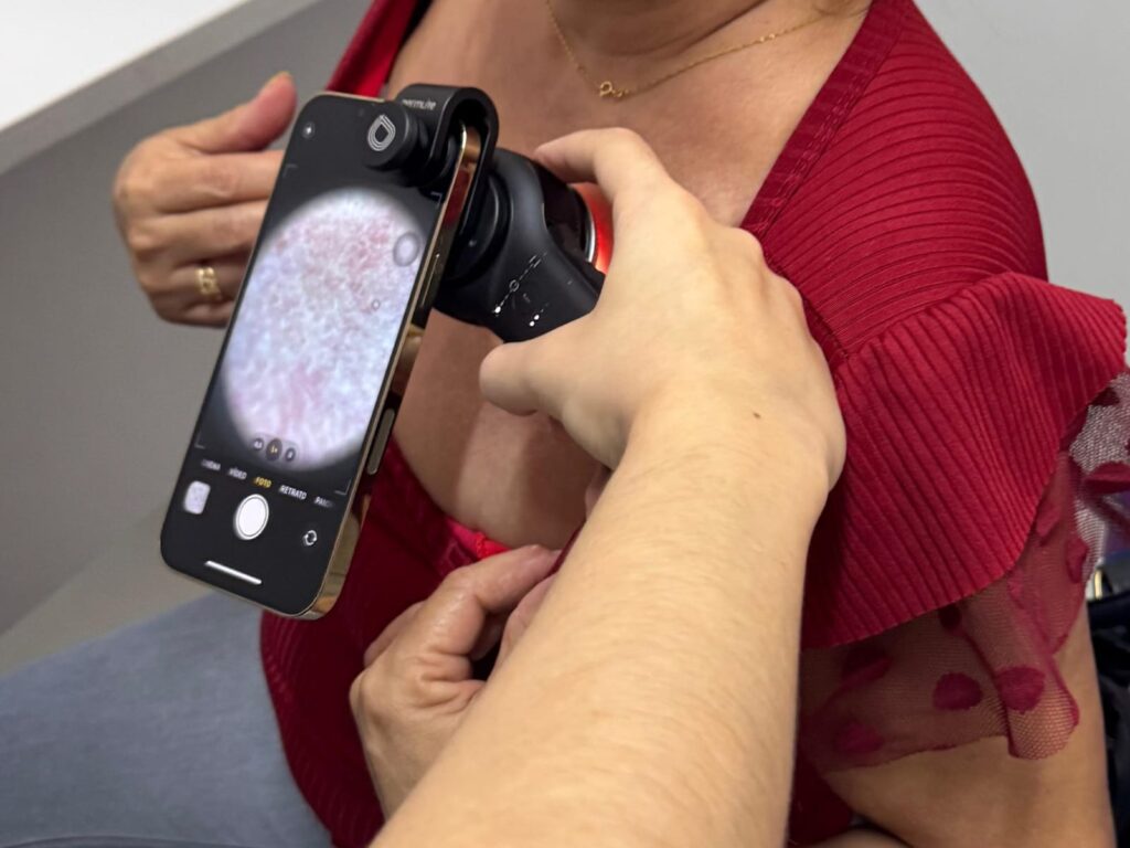 Diagnóstico da hanseníase avança e agiliza tratamento e cura em Belém