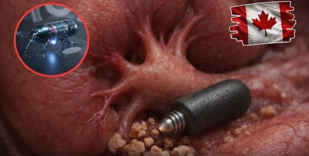 Vídeo: Micro-robô magnético promete revolucionar tratamento de pedras nos rins