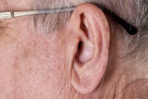 O que é o sinal de Frank?