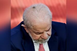 Lula tira lesão de câncer de pele no couro cabeludo e tem alta para casa