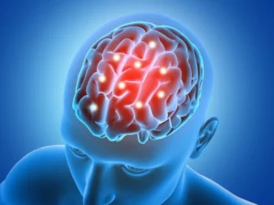 “Marcapasso cerebral”: como funciona tecnologia que trata Parkinson e TOC